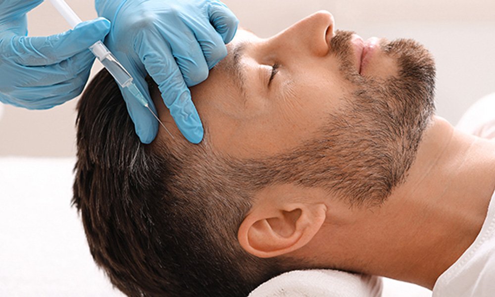 mesotherapy