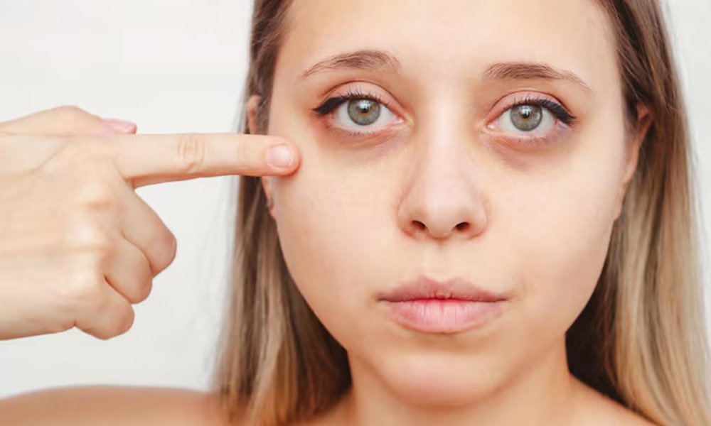 eyelid-malpositions