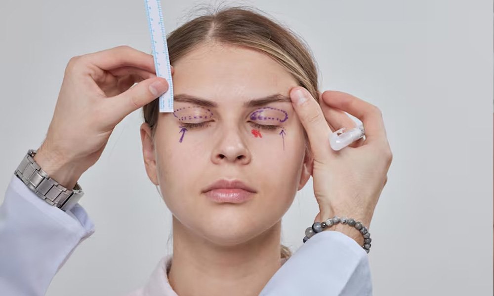 Ptosis Repair