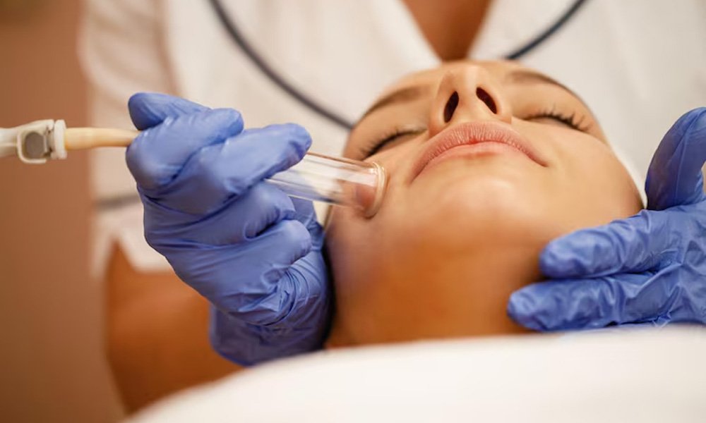 acne-scar-laser-treatment