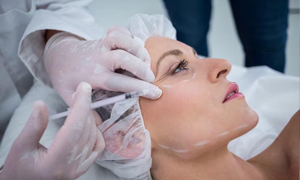 botox