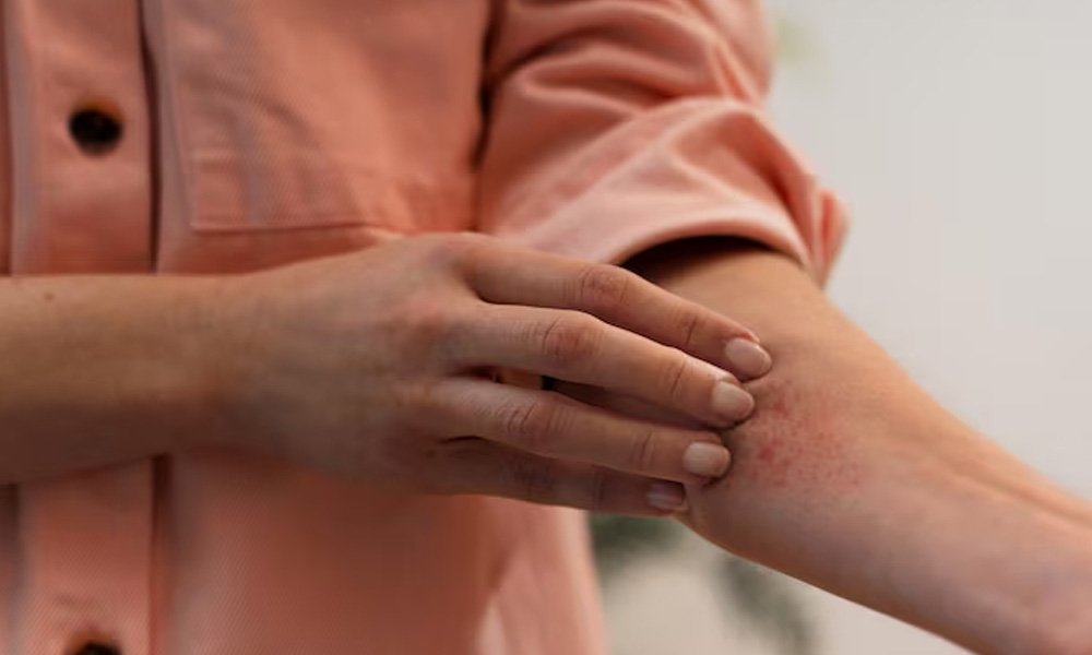 fungal-infection-treatment