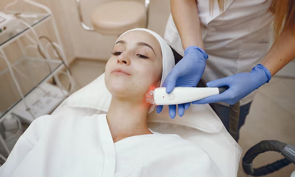 laser-skin-tightening