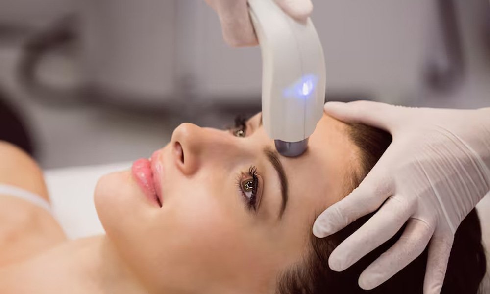 pigmentation-removal