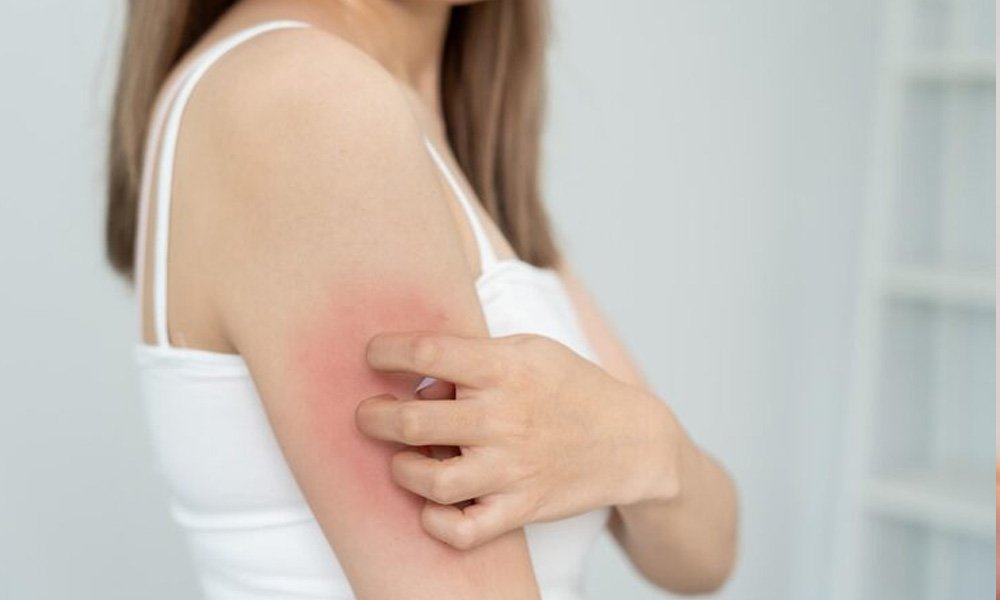 skin-allergy-treatment